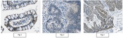 MilliporeSigma Mouse anti-IDH1/2 Mutant (R132/172), Clone: MsMAb-1, 100 &mu;g | Buy Online | MilliporeSigma&trade; | Fisher Scientific